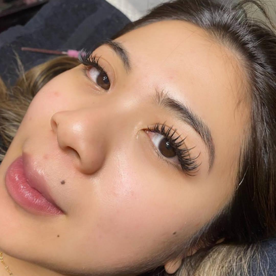 Alta Esthetics photo 15