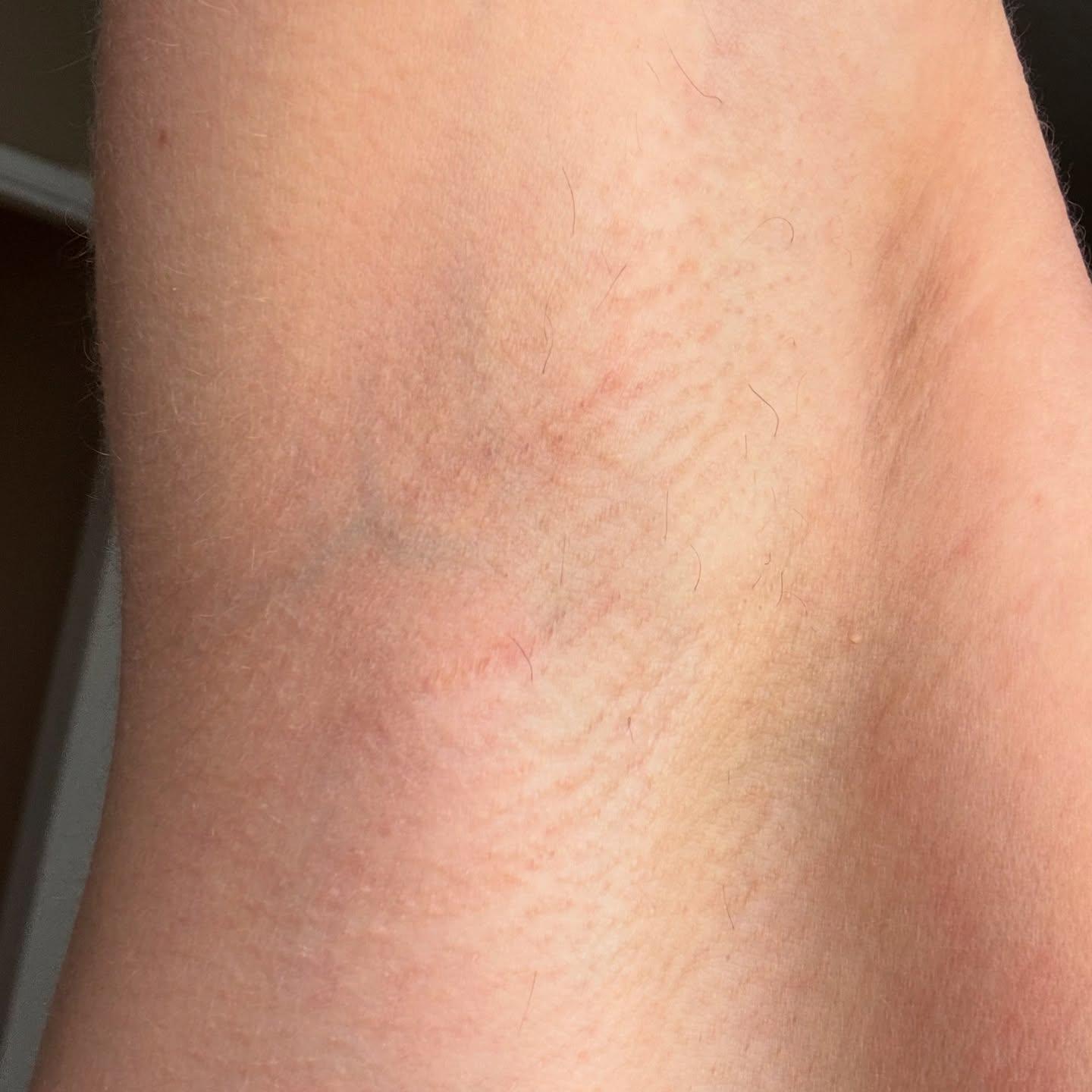 Luxe Laser and Beauty photo 8