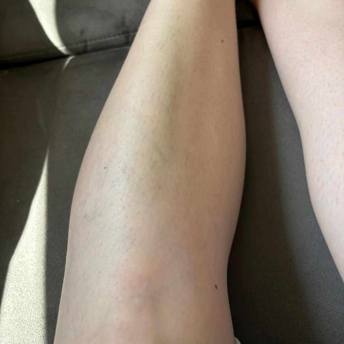 Luxe Laser and Beauty photo 3