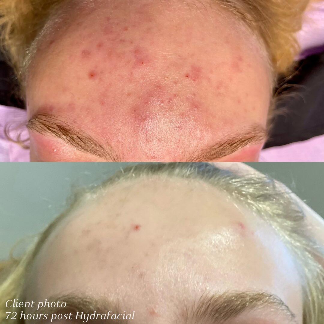 Samantha Nicole Esthetics photo 4