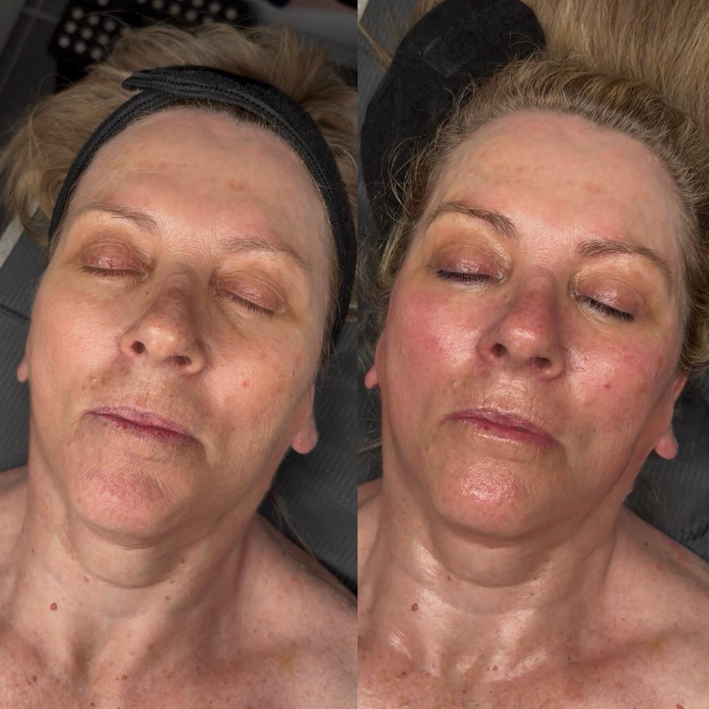 Samantha Nicole Esthetics photo 13